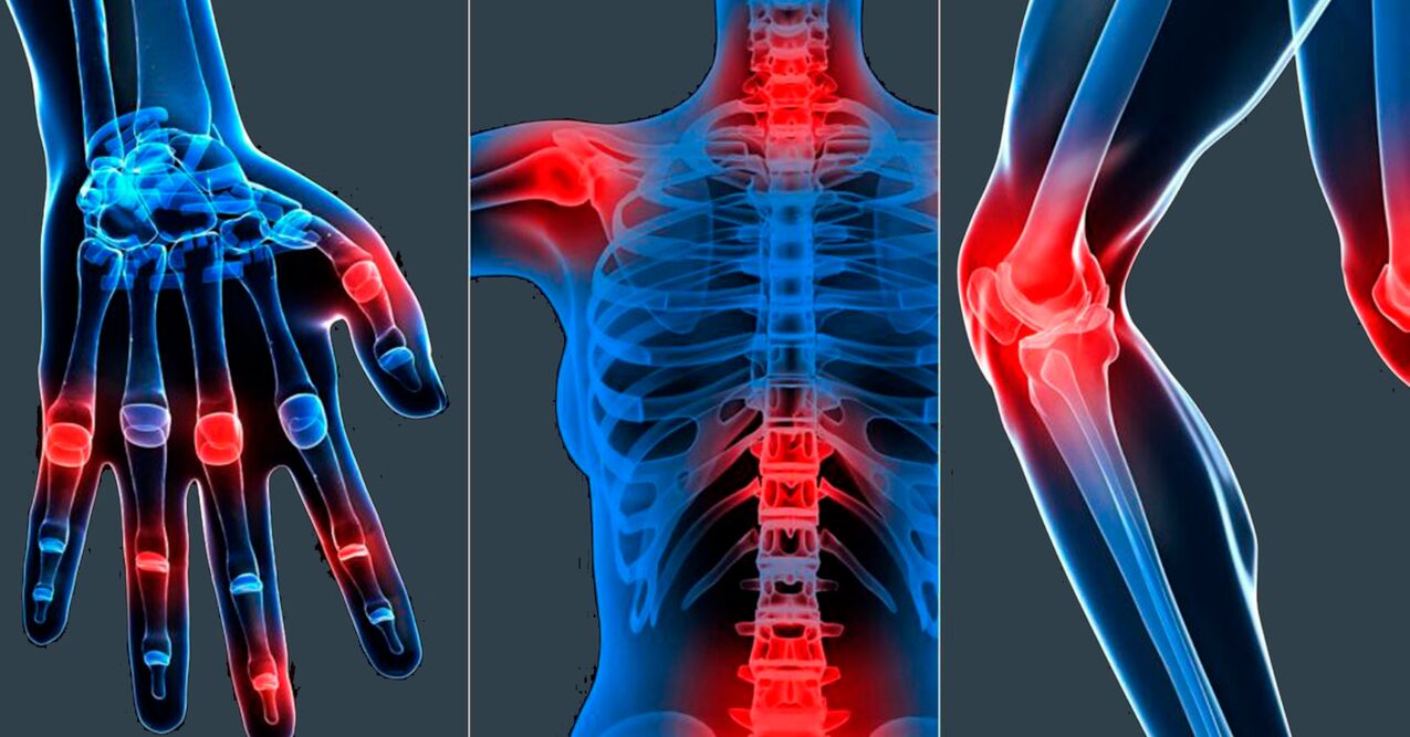 Boswellia extract kapsuletan erabiltzeko adierazpenak